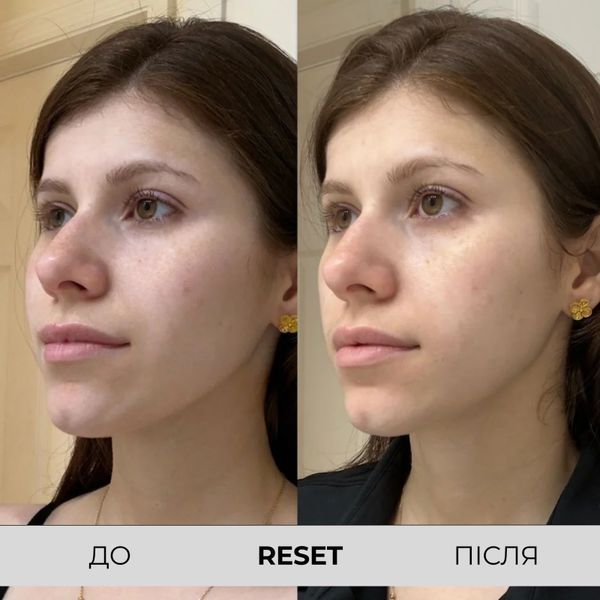 Поживний очищувальний засіб для обличчя PSA Reset Acai and Manuka Honey Nourishing Cleanser  PSA01 фото