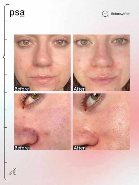 Антиоксидантна нічна сироватка PSA Goals Multi Acids and Probiotics Perfecting Night Serum  PSA06 фото
