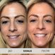 Антиоксидантна нічна сироватка PSA Goals Multi Acids and Probiotics Perfecting Night Serum  PSA06 фото 2