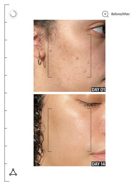 Відновлюючий крем-бальзам для обличчя Allies of Skin Molecular Barrier Recovery Cream Balm AOS11 фото