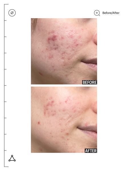 Нічна анти-акне маска з 2% діоєвою кислотою Allies of Skin Promise Keeper Blemish Sleeping Facial  AOS12 фото