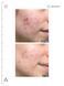 Нічна анти-акне маска з 2% діоєвою кислотою Allies of Skin Promise Keeper Blemish Sleeping Facial  AOS12 фото 6