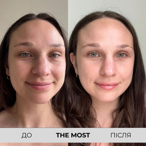 Зволожуюча поживна сироватка PSA The Most Hyaluronic Super Nutrient Hydration Serum  PSA10 фото